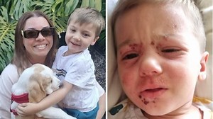 He looked like a vampire had attacked his face