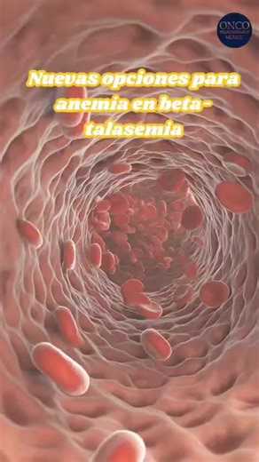 Las nuevas opciones terapéuticas para la anemia asociada a beta-talasemia buscan mejorar la producción de glóbulos rojos en ciertos casos. La información clara es parte del acompañamiento. #BetaTalasemia #Anemia #Salud #AltaEspecialidad #OncoEspecializados https://www.oncoespecializados.com/