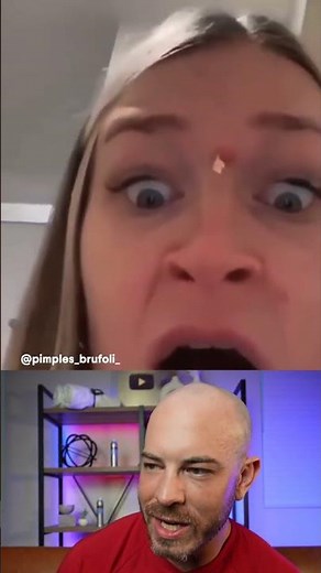 Foul Infected Pimple Pop! #dermreacts #doctorreacs #pimplepopper