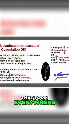 Disseminated Intravascular Coagulation: (DIC) : Causes, Symptoms, and Clot Formation #shorts