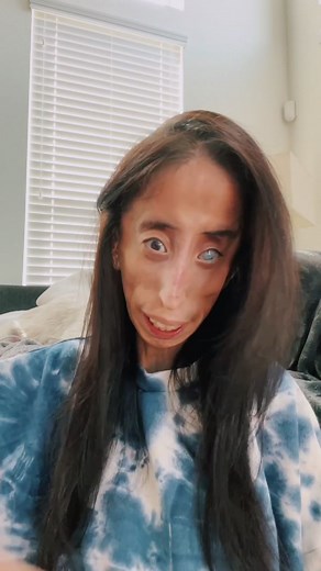 Embracing Uniqueness: Lizzie Velasquez's Journey to Self-Love