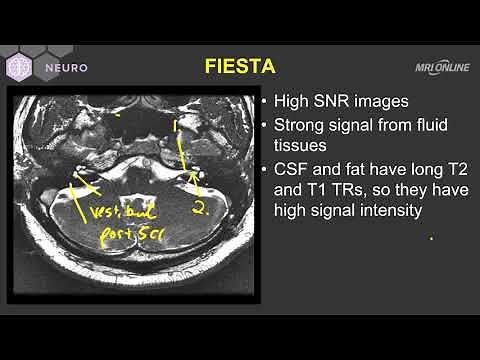 Technique on MRI - Inner Ear MRI - Medality (MRI Online) Radiology Noon Conference