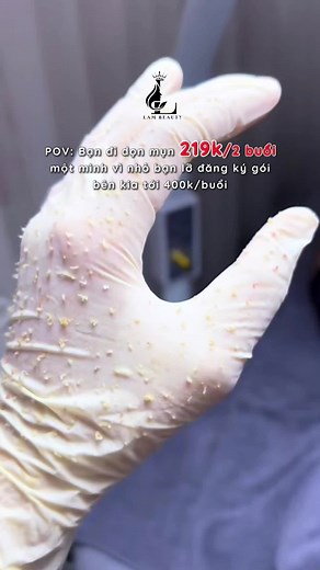 🔥Học sinh - Sinh viên ơi! #DEAL_XỊN cho da mụn đây! KIỂM SOÁT MỤN TẠI LAM BEAUTY CHỈ #219K/2 BUỔI🔥 🌟LAM BEAUTY SPA TÂN PHÚ 📍79 Lê Đình Thám, Phường Tân Sơn Nhì(Quận Tân Phú cũ), TPHCM #laynhanmun #mun #spatanphu