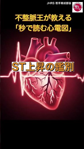 【不整脈医が教える「秒で読む心電図」】