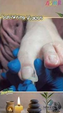 ASMR Nails Cleaning #satisfying #Relaxing #Nails. Clipped, pedicure, podiatry. #vlogmas #shorts