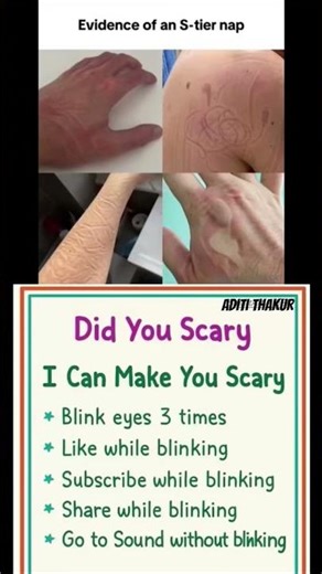 Evidence Of an S-Tire nap #shortvideo#trending