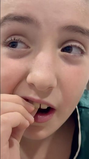 Oliver and Lucas Pull a Loose Tooth 🦷 Losing a Baby Tooth #educationalvideosforkids