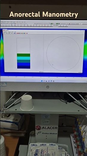 Biofeedback therapy - Very important in Constipation!!