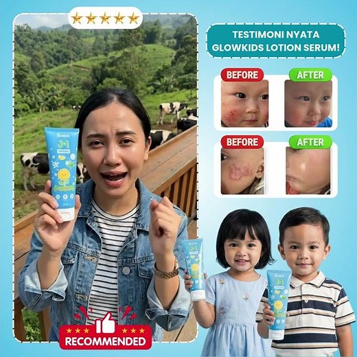 Tips Mengatasi Biang Keringat pada Anak Agar Tidak Gatal