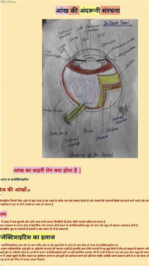 conjunctivitis eyes treatment