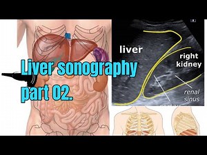 How to Image the Liver on Ultrasound | Liver Sonography Part 2