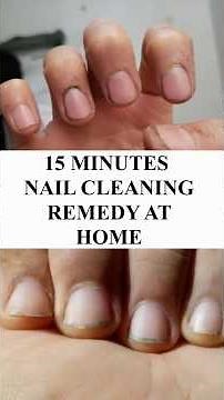 15 Minute Nail Cleaning Remedy at Home 💅