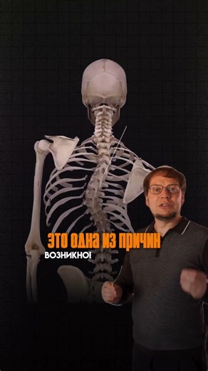 Why scoliosis CANNOT be cured by exercises alone? Roman Erokhov #osteopathy #eeco #scoliosis