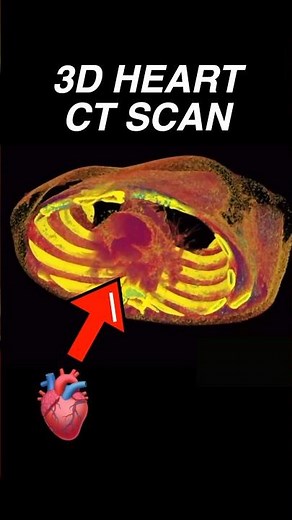3D Human Heart CT scan #cardiology #radiology #anatomy #medical #education #medicalstudent