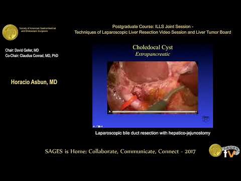 Laparoscopic Bile Duct Resection with Hepaticojejunostomy • Video • MEDtube.net