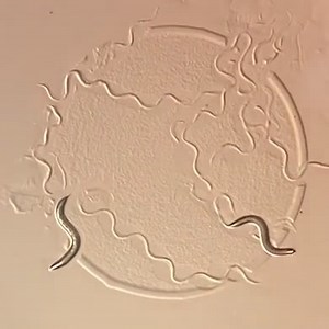 C. elegans study finds mRNA balance in cells influences lifespan