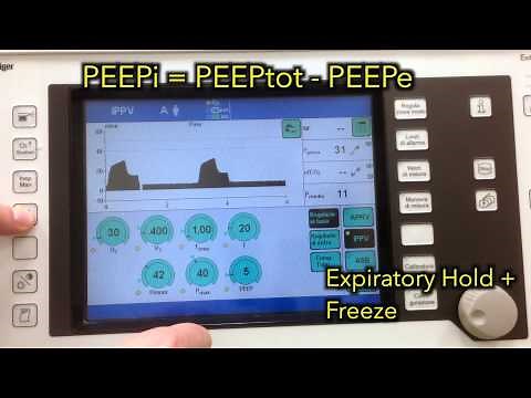 Intrinsic PEEP (or auto-PEEP) on Draeger Evita 4 ventilator