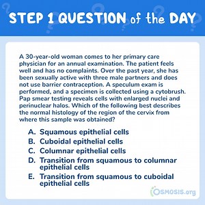 USMLE® Step 1 Question of the Day: Cervix - Osmosis Blog