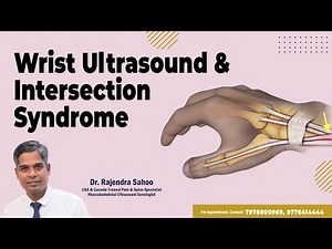Wrist Ultrasound And Intersection Syndrome - Everything You Need To Know || Dr. Rajendra Sahoo