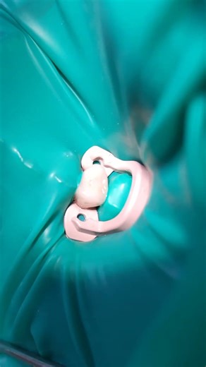 Single isolation 15 tooth.#cofferdamrubber #раббердамология