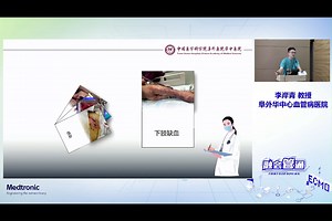 危重症患者ECMO治疗与护理 李岸青