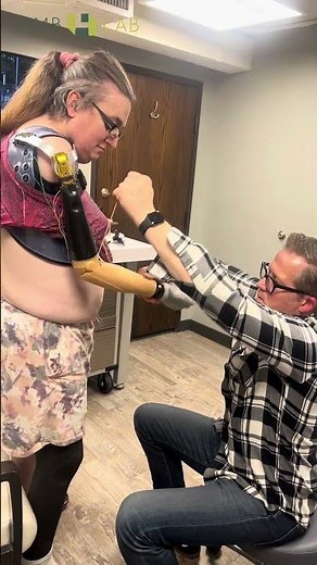Shoulder Disarticulation Prosthesis