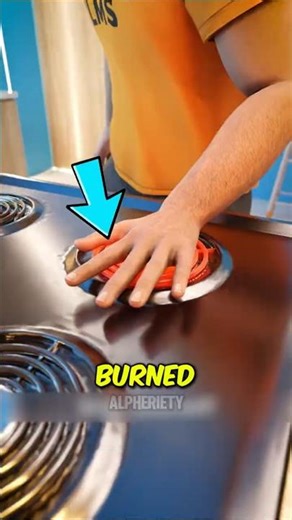 Burned Yourself NEVER Do This 😳
