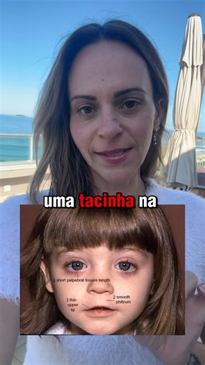 Priscila Antunes CRM 109981-7 on Instagram: "Te ensino passo a passo correto do que pode ou não pode fazer na gestação no curso MÊS A MÊS. Digita aqui GRAVIDEZ e me deixa te ajudar 🦋 na fase mais importante de sua vida !! Há uma vasta literatura científica sobre os efeitos do consumo de álcool na gestação, com destaque para a Síndrome Alcoólica Fetal (SAF) e o Espectro de Transtornos do Álcool Fetal (FASD – Fetal Alcohol Spectrum Disorders). Crianças expostas ao álcool durante a gestação aprese