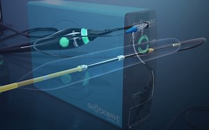 16.Shockwave Intravascular Lithotripsy (IVL) System