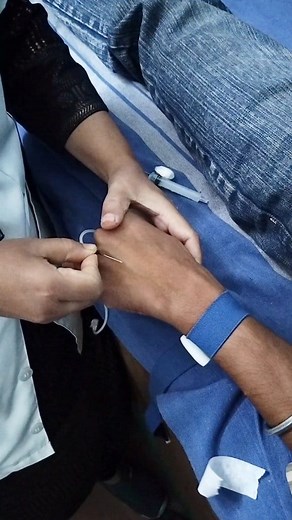 18K views · 42 reactions | how to inserted Butterfly in to the vein #scalp #scalpvan #butterfly #ivset #intravenous #realestate #realvideo #facebookreel #facebookreelsviral #facebookreelsvideo #fbviralpost2025シ #fblifestylechallenge #fbreels2025ツ #fvreelsviralvideo #fbreelsfypシ゚ #fbreelsvideo #fbreelsfypシ゚viralfbreelsfypシ゚viral #fbreelsfypシ゚viralvideo #fbreelsviral | Momotaz Islam | Facebook