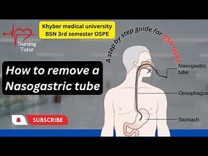 How To Remove An Ng Tube | The Removal Procedure | A Guide For Ospe And Osce