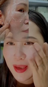 Get Noticeably Brighter Skin from the First Use – Powerful Natural Whitening Remedy!"#SkinWhitening #InstantGlow #GlowingSkin #NaturalBeauty #DIYFaceMask #ClearSkin #SkincareSecrets #BeautyHack #RadiantSkin #FirstUseResults | Beauty Tips Tb