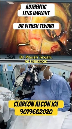 🔴 Live Cataract Surgery | Alcon Clareon IOL Implantation | Authentic Lens Implant | Dr Piyush