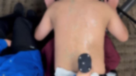 This video shows a real spinal scan, captured from above the patient. What you are seeing is a live 3D reconstruction being generated during the ultrasound scan. It may look like XR, but it is not.… | Christopher Schlenger