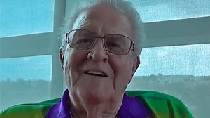 Knuckle Replacement Surgery Helps Patient Live Pain-Free