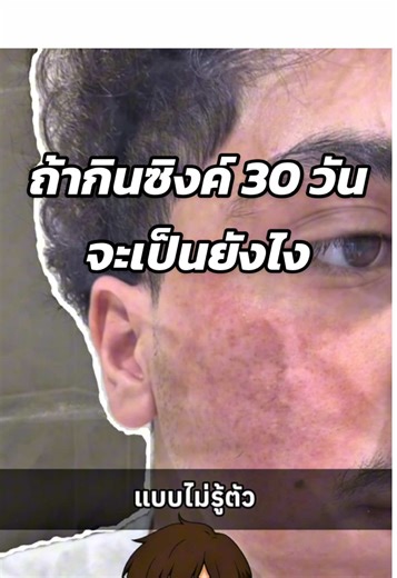 ถ้ากินซิงค์ 30 วัน จะเป็นยังไง #สาระความรู้ #เมดิต้าซิงค์พลัส #ซิงค์ลดสิว #meditazinc #ซิงค์