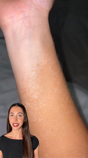 Quick Flick on Instagram: "You’ve been brainwashed by the fake tan industry.. but that’s not your fault 👀 Fake tan formulas have improved massively in the last 5 years, yet so many brands are still pumping out the same harsh, drying, dye-loaded formulas and marketing them as “the best” 🙄 Why? Because those formulas are cheap to make and very, very profitable 💰 Quick Glow was made for the people the industry forgot ✨ Dye free ✨ Alcohol free ✨ High purity naturally derived DHA ✨ Skincare based 