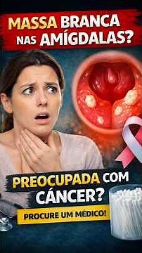 Massinha ou bolinha branca na garganta: é câncer?