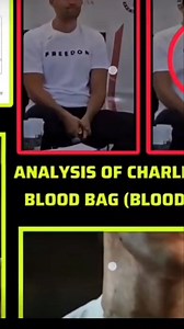 3 comments | CURIOUS CASE OF A CRISIS ACTOR !!! For Entertainment...