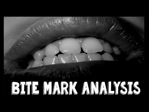 What is Bite Mark Analysis?