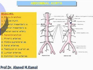 64- Abdominal aorta (Abdomen)