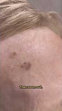 Two lesions. One mistake.