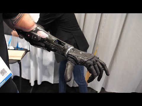 Psyonic - Touch-Sensing Bionic Ability Hand - Interview - CES 2022 - Poc Network
