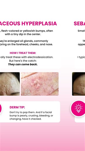 Skin Bumps 101: 8 Common Types Explained