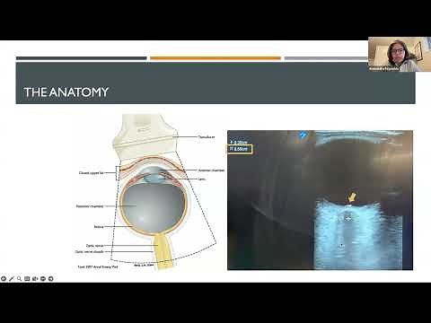 Neurocritical Care & Pearls: Noninvasive Monitoring of Intracranial Pressure, Alexandra Reynolds, MD