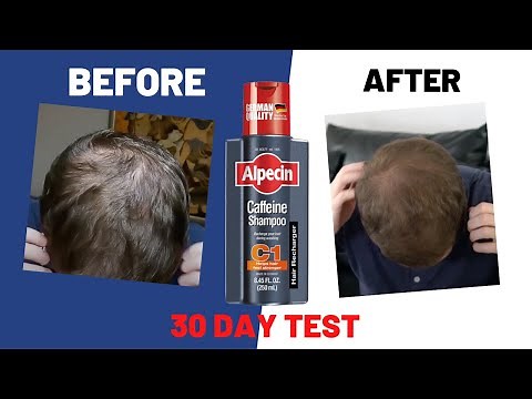 I used "Alpecin Caffeine Shampoo" for 30 days. Here's what happened...