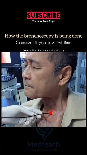 🔍 What Happens During a Bronchoscopy? — See How Doctors Look Inside Your Lungs! #bronchoscopy