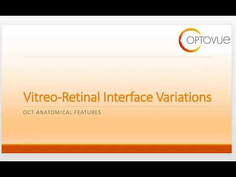 OCT Interpretation Session 2: Vitreo-Retinal Interface Variations
