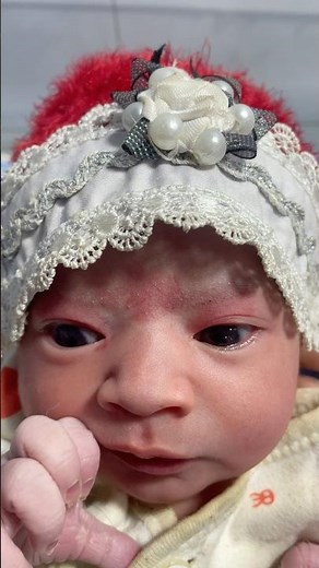 Cute baby #shortsfeed #baby #premature #babypictures #cute #lifeisbutadream #cutebaby