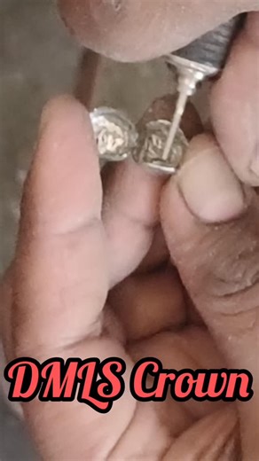 Dr. Vishal Mishra⚕️ on Instagram: "DMLS For Consultation: 8456970962 DMLS technology, DMLS process, metal 3D printing, direct metal laser sintering, additive manufacturing, 3D printing metals, DMLS applications, industrial 3D printing, advanced manufacturing, laser sintering, additive design, metal fabrication, DMLS materials, rapid prototyping, 3D printing techniques, engineering innovation, manufacturing technology, metal additive processes"